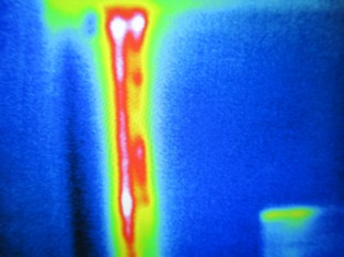 Thermografiekamera